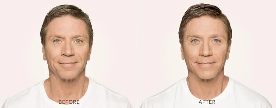 injectables bamp;a