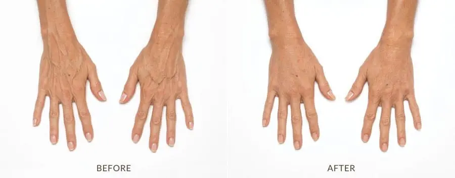 injectables bamp;a